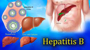 Hepatitis Virus Range